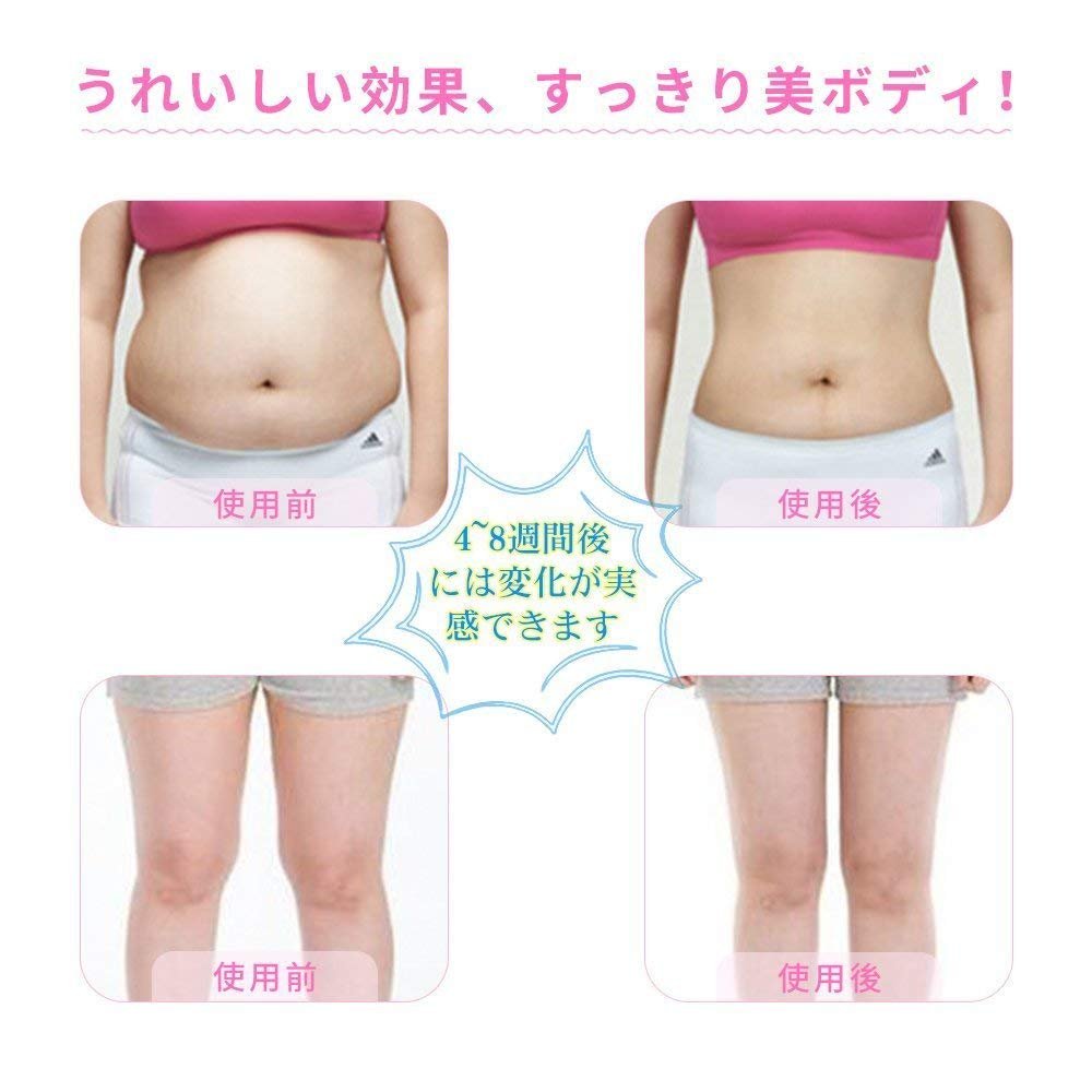 Amazon.co.jp: Vioiu セルライト 家庭用 キャビテーション 冷凍